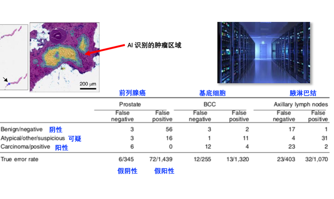 病理分析