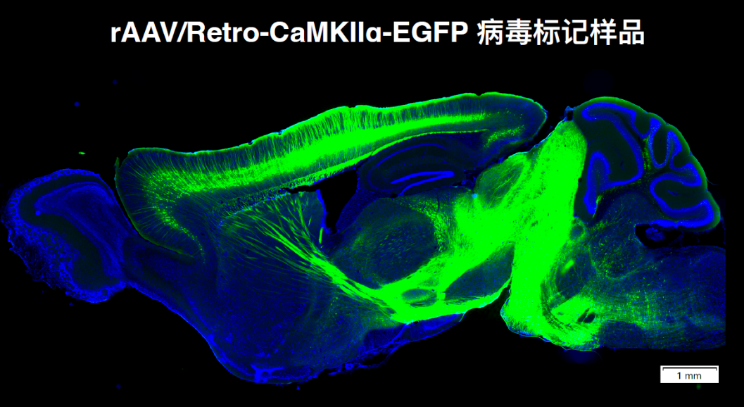 北京大学国家生物医学成像科学中心新置VISoR系统完成安装调试并投入使用