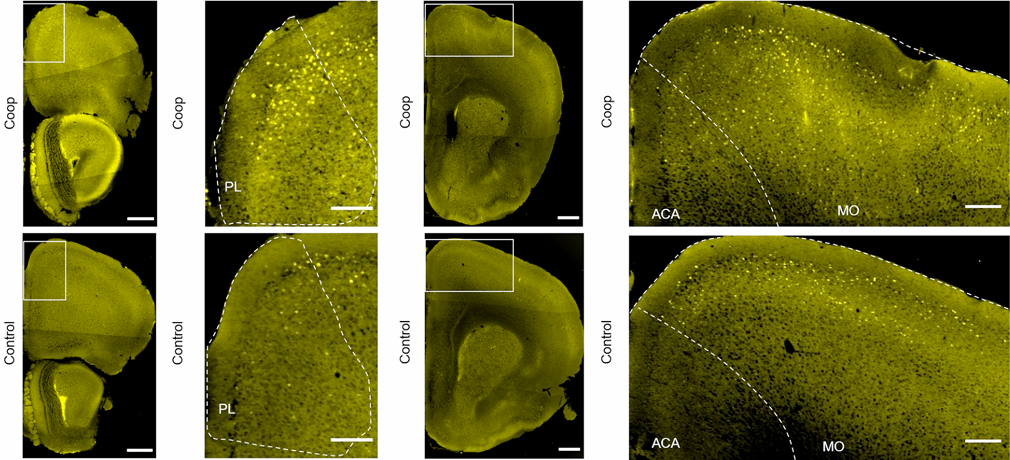北京大学国家生物医学成像科学中心新置VISoR系统完成安装调试并投入使用