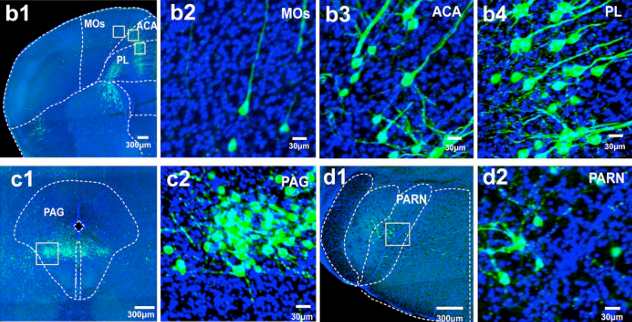 北京大学国家生物医学成像科学中心新置VISoR系统完成安装调试并投入使用